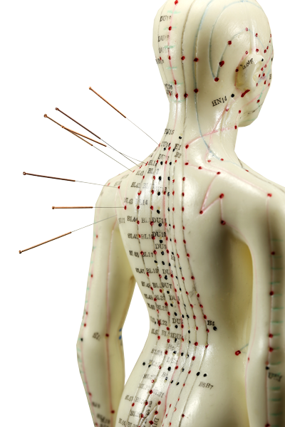 Acupuncture Fayetteville - Healing Point Chiropractic